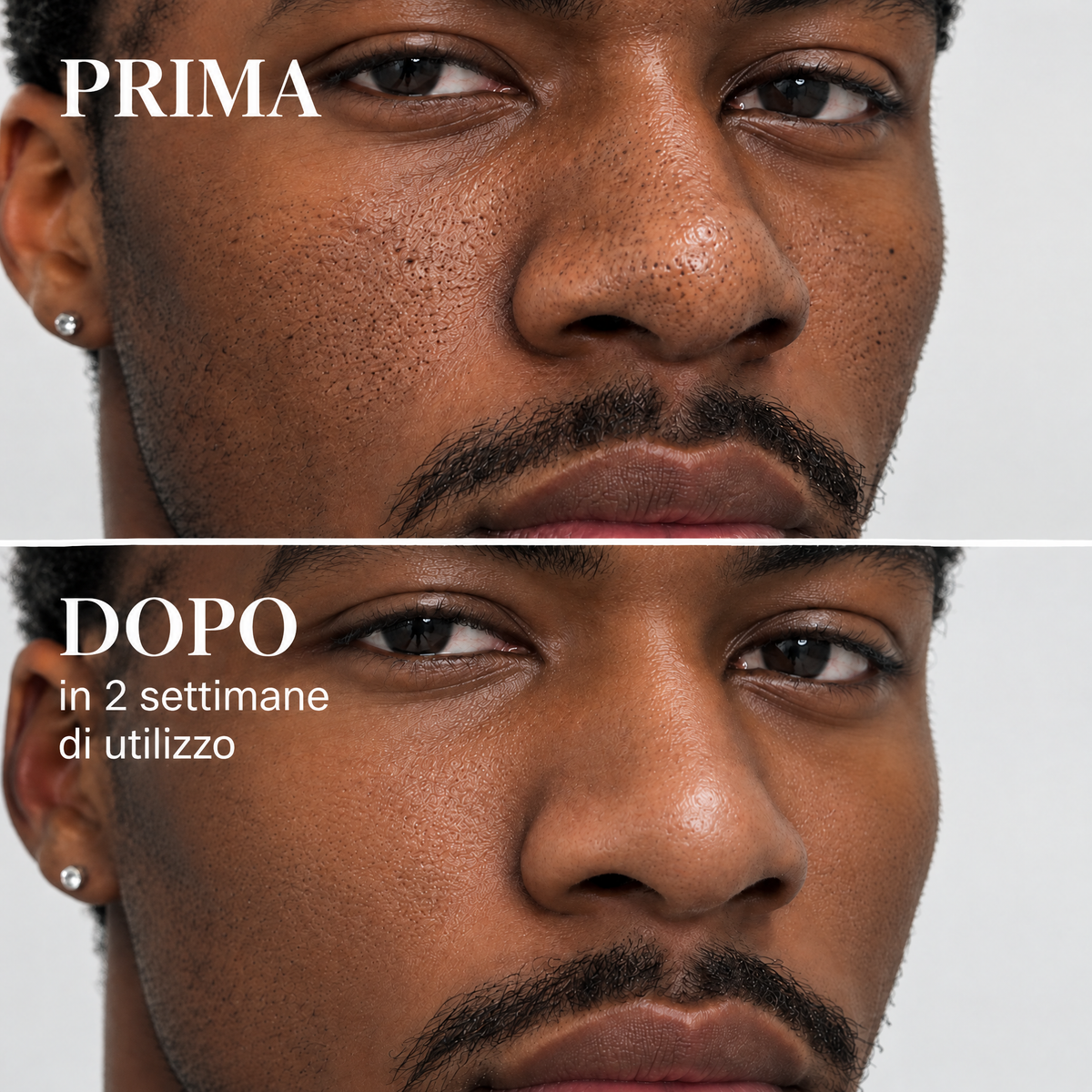 Maschera Zero Pori & Punti Neri Vaelia™