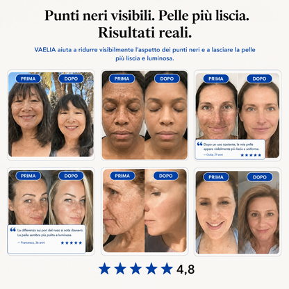 Maschera Zero Pori & Punti Neri Vaelia™