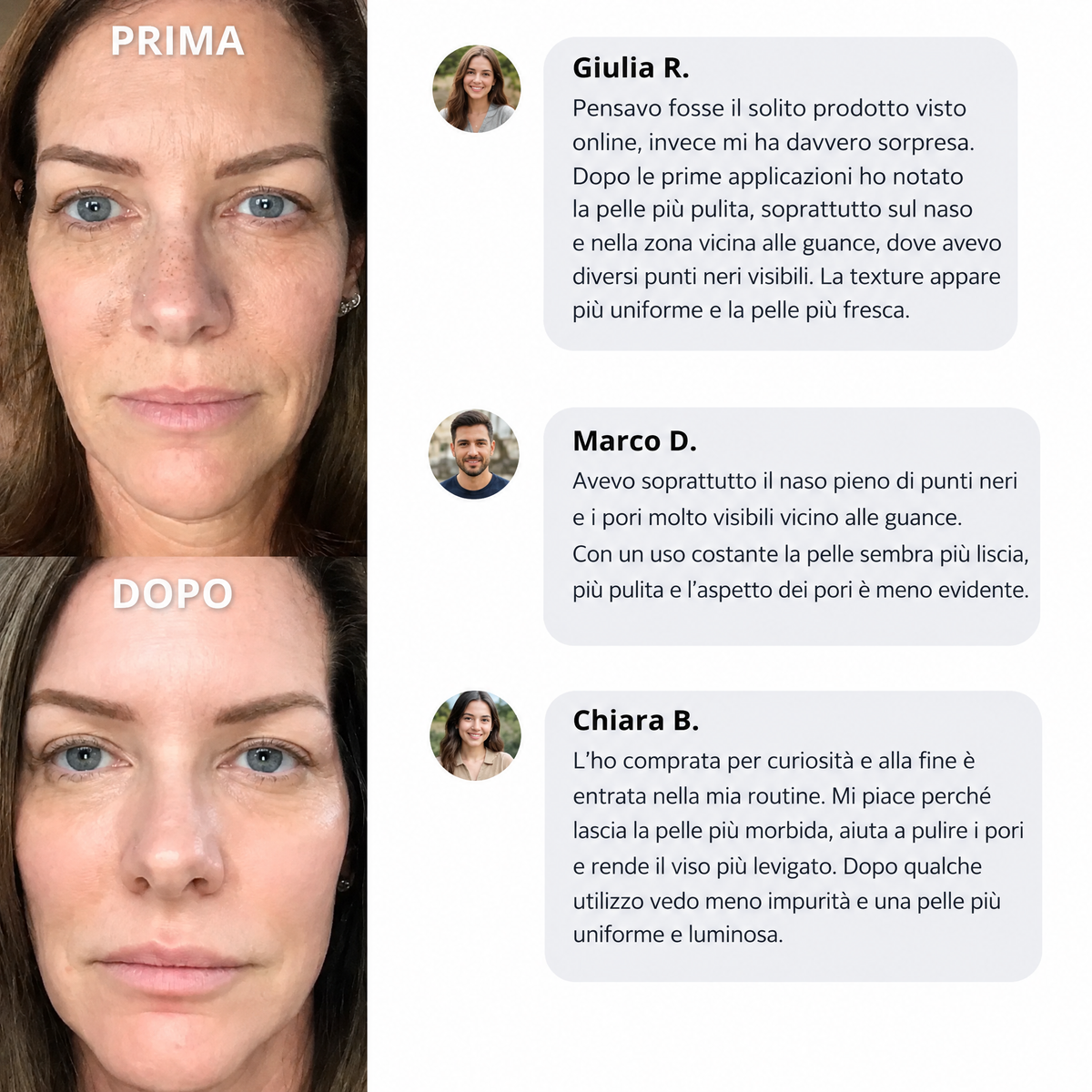 Maschera Zero Pori & Punti Neri Vaelia™